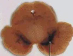 正常人：正：谥