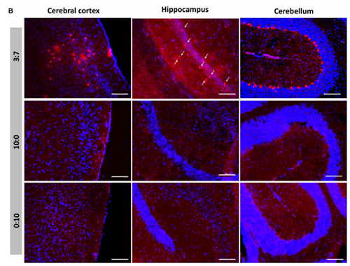 被包裹在含有NT-类脂质的LNP中的Cre重组酶成功转移。大脑中的转染神经元呈红色高亮。