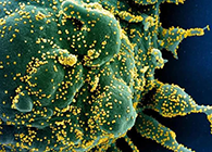 唾液检测新冠抗体新方法来了，获取结果仅需几小时！