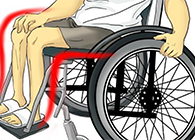 Nature：还瘫痪患者一个自由身的日子不远了